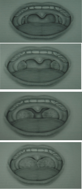 1 1.png